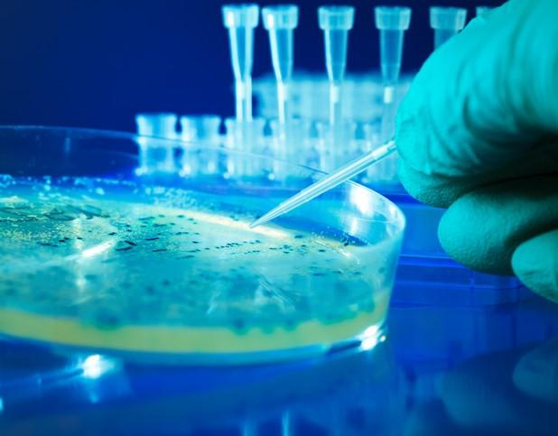 Salmonella colonies in petrie dish