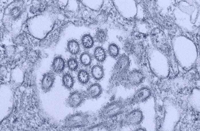 2009 H1N1 influenza virus