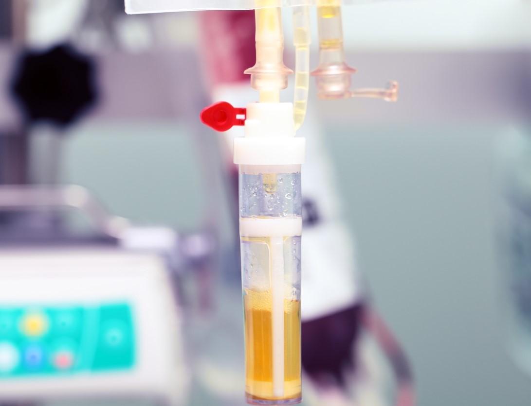 Plasma transfusion
