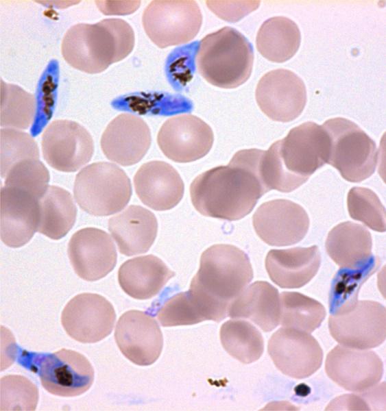 Plasmodium falciparum