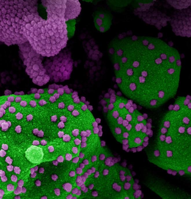 SARS-CoV-2 viruses under microscope