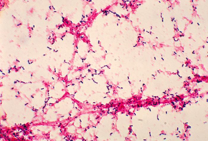 This is a photomicrograph of Streptococcus pneumoniae bacteria having been grown from a blood culture.