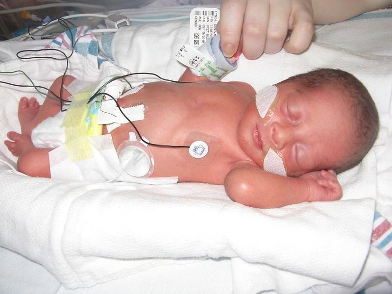 Premature baby boy