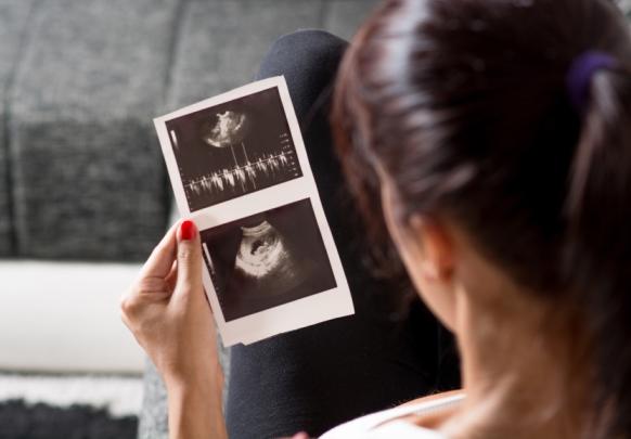 Pregnant woman with ultrasound