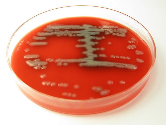 Pseudomonas aeruginosa