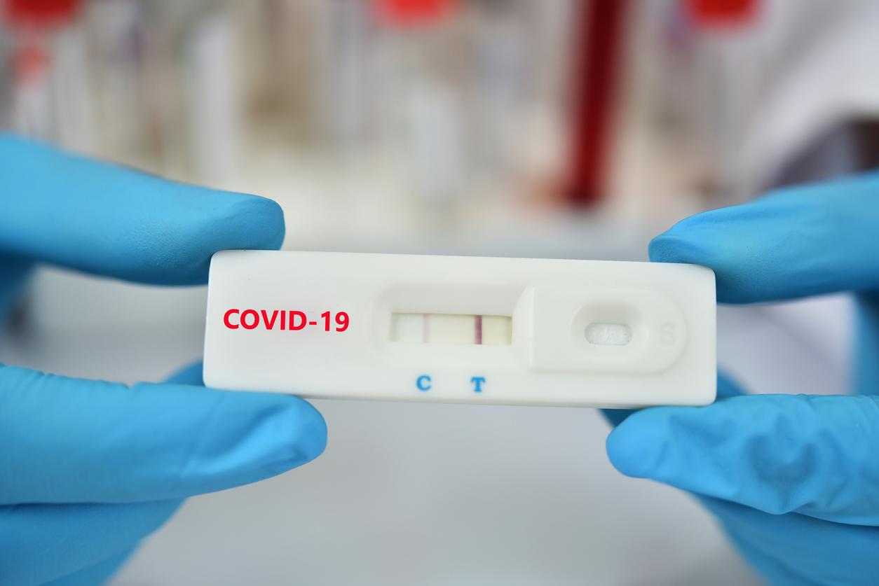 COVID-19 RAPID TEST – RAPID TEST COVID-19