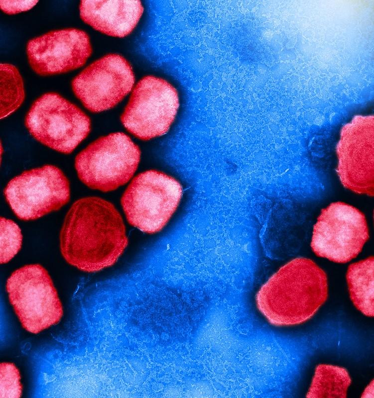 Monkeypox viruses as seen through a microscope