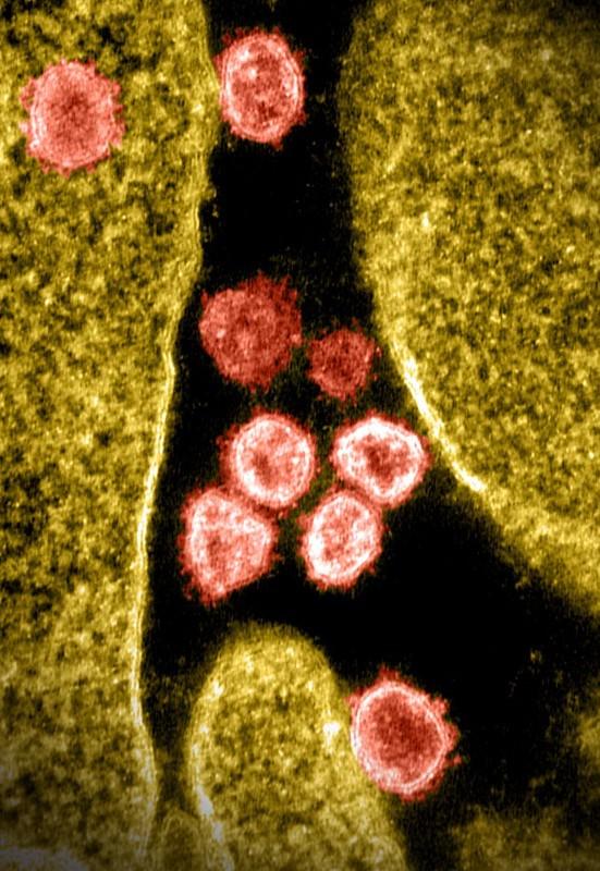 SARS-CoV-2 viruses