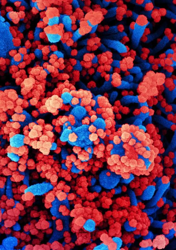 Red SARS-CoV-2 infecting blue cells