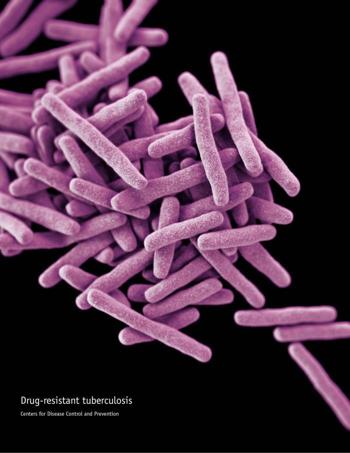 Drug-resistant Mycobacterium tuberculosis