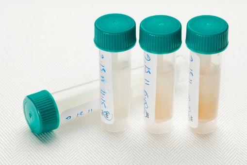 Saliva samples