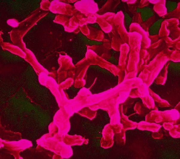 Salmonella Typhi, which causes typhiod fever