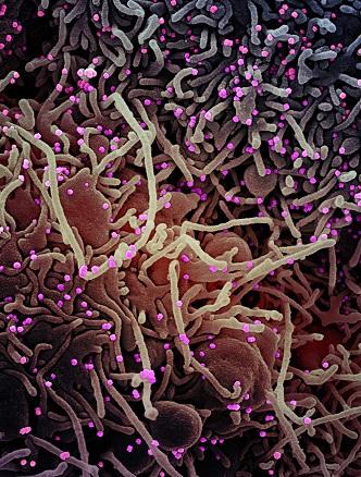 COVID-19 virus, highly magnified