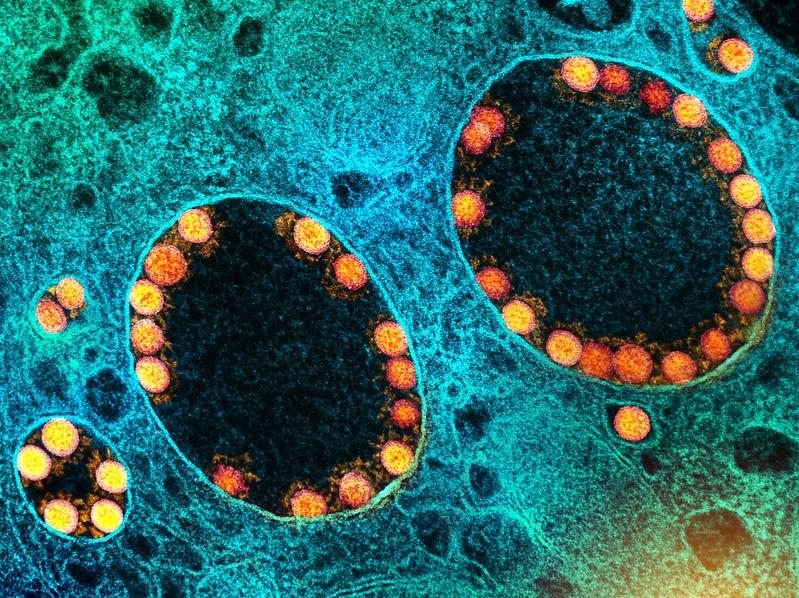 SARS-CoV-2 viruses, highly magnified