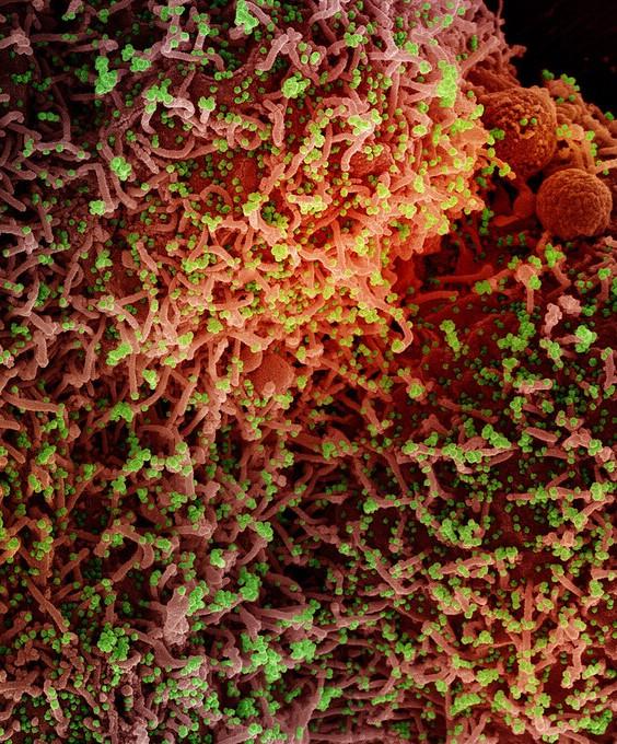 SARS-CoV-2 highly magnified
