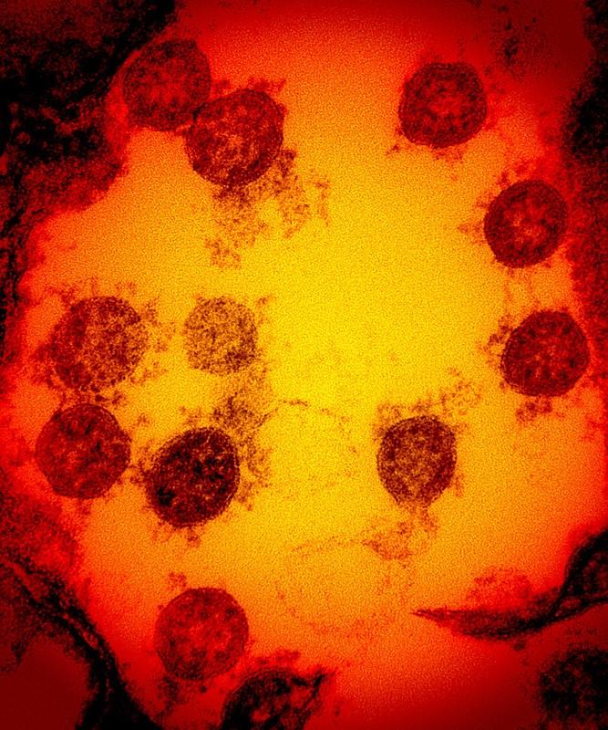 SARS-CoV-2, the virus that causes COVID-19