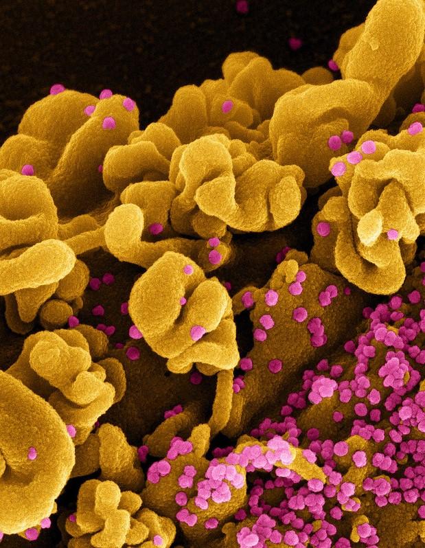SARS-CoV-2 Omicron viruses infected a cell