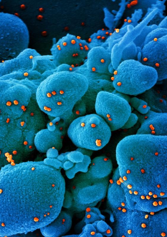 SARS-CoV-2 viruses magnified
