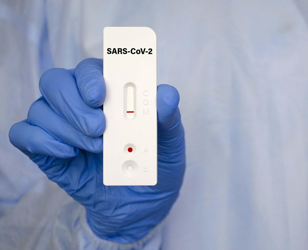 SARS-CoV-2 rapid test