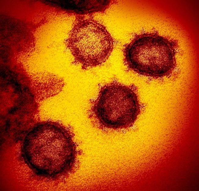 SARS-CoV-2 viruses highly magnified