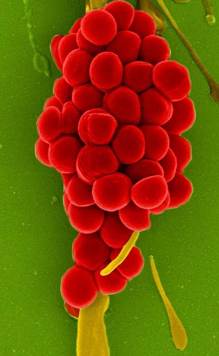 Staphylococcus aureus