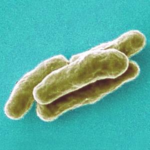 Mycobacterium tuberculosis highly magnified