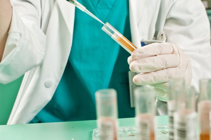 Urine test