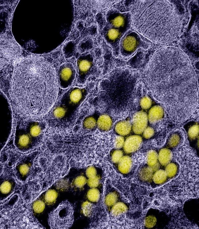 SARS-CoV-2 COVID-19 viruses