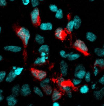 Zika-infected neural cells