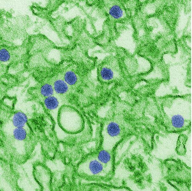 Zika virus