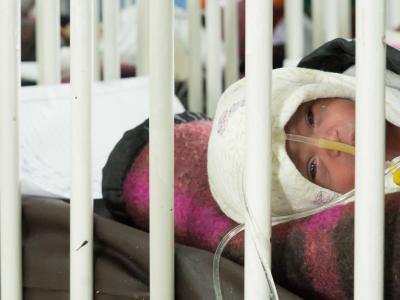 Baby with sepsis