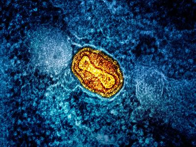 mpox cell