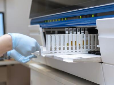 Analyzing urine samples