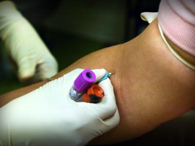 blood draw