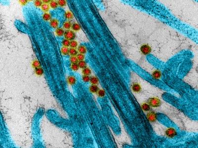 covid in epithelium