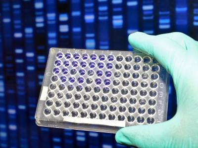 DNA testing
