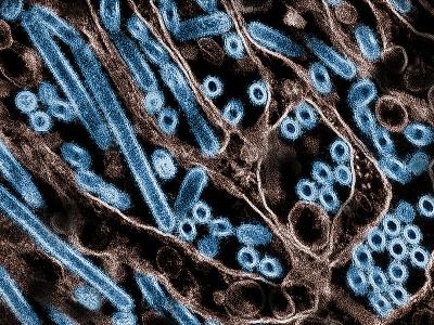 H5N1 virus