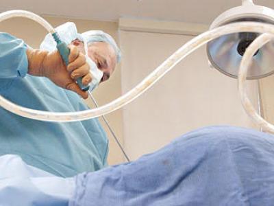 Liposuction