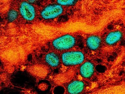 Mpox viruses highly magnified