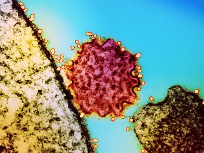Nipah virus particles