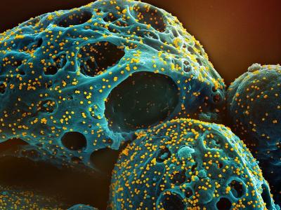 Omicron micrograph