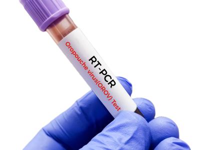 Oropouche test