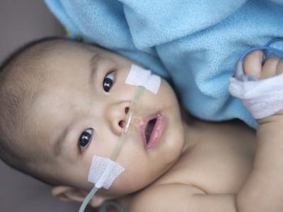 baby on oxygen