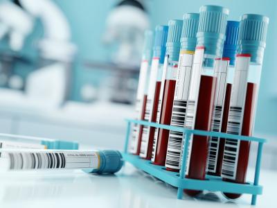 blood samples
