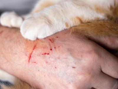 cat scratch