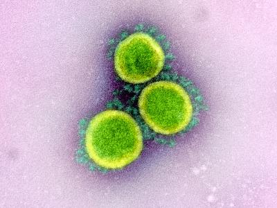 SARS-CoV-2 in pastel