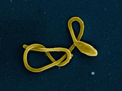 ebola virus
