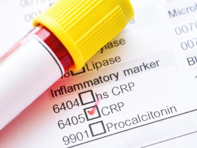 CRP test