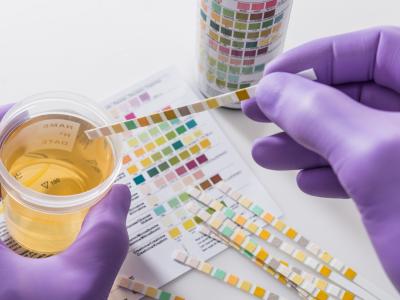 Urinalysis
