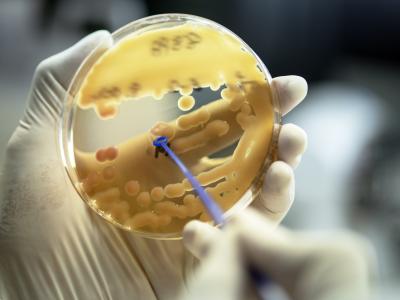 Klebsiella pneumoniae colonies